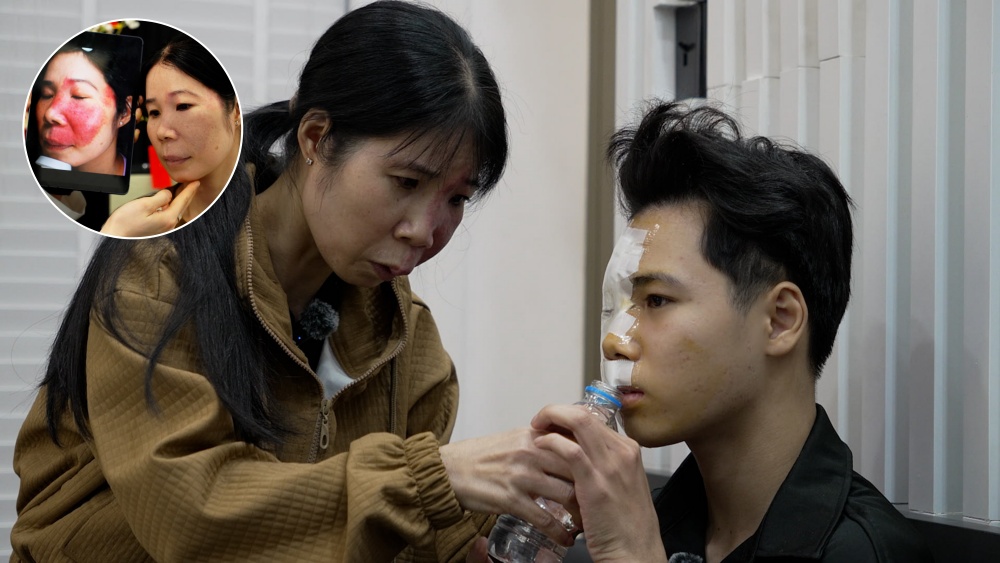 Mang bớt đỏ nửa mặt, người mẹ chỉ xin điều trị cho con bạch biến