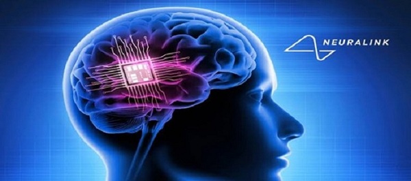 Chip não Neuralink đã được cấy ghép cho bệnh nhân thứ hai